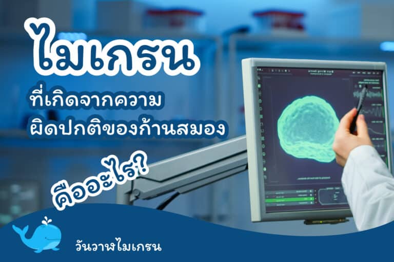รู้จัก “ไมเกรนที่เกิดจากความผิดปกติของก้านสมอง”